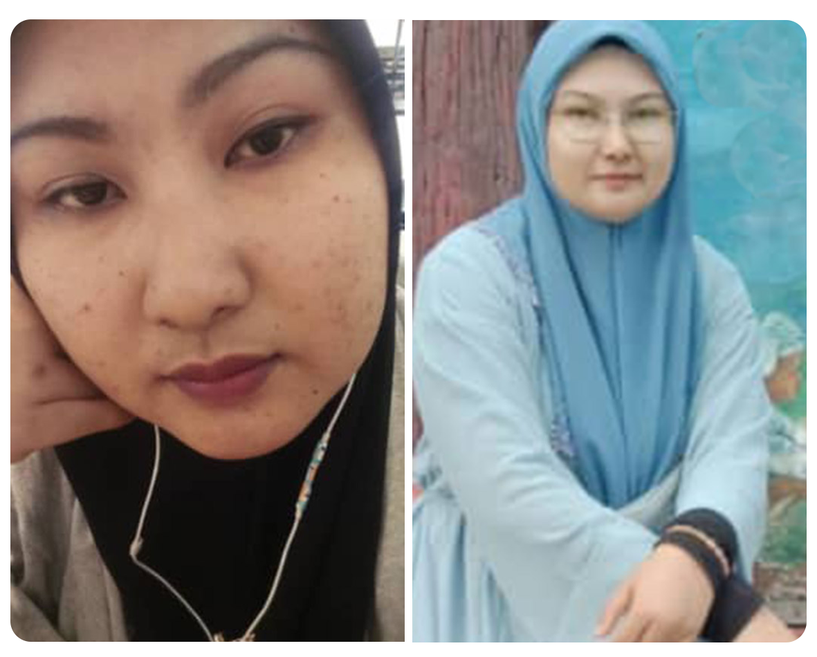 Before and after pengguna Gluvy 2
