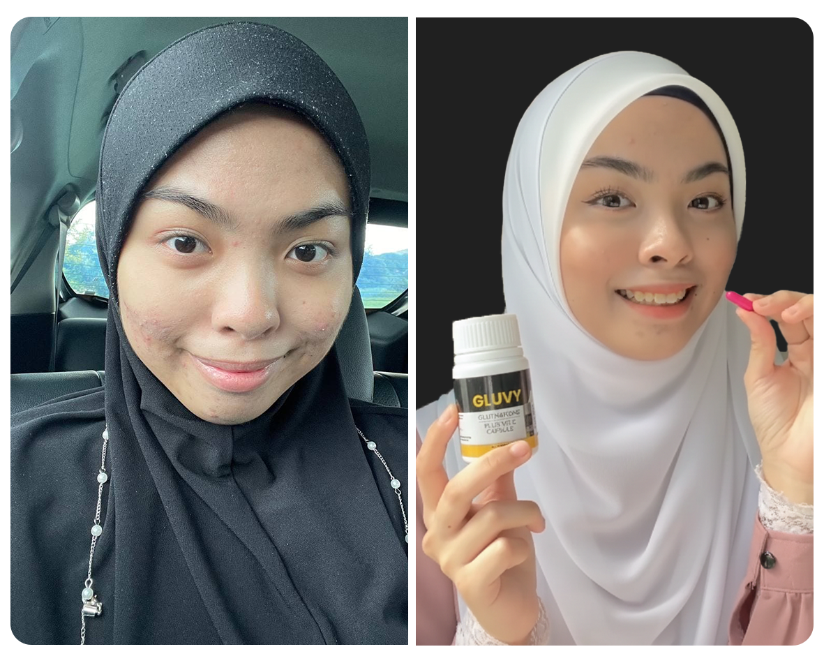 Before and after pengguna Gluvy 6