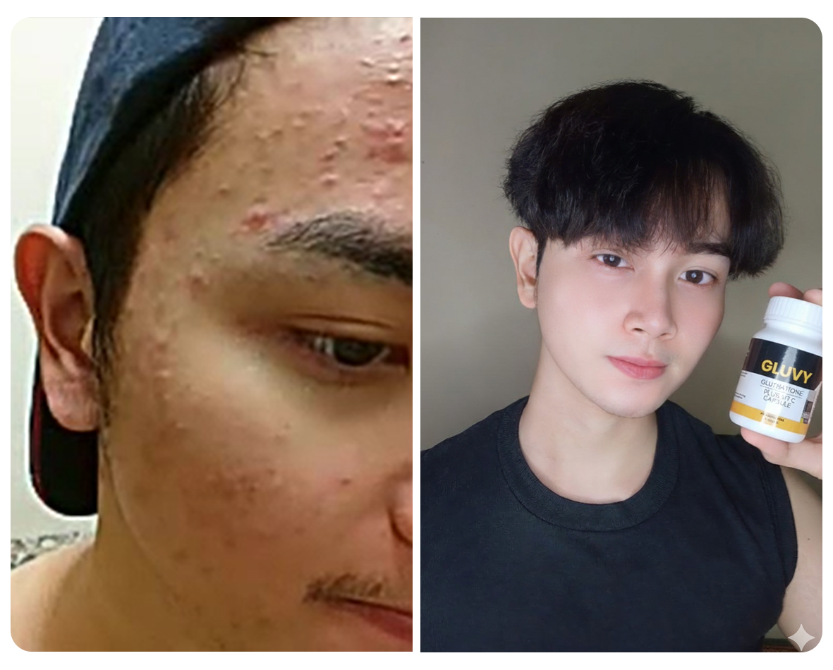 Before and after pengguna Gluvy 7